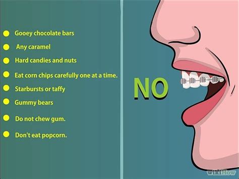 10 Things to Avoid When Wearing Braces